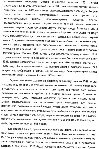 Система и способ продувки устройства пониженного давления во время лечения путем подачи пониженного давления (патент 2404822)