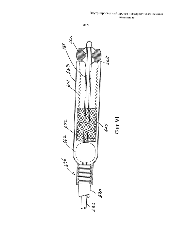 Внутрипросветный протез и желудочно-кишечный имплантат (патент 2626885)