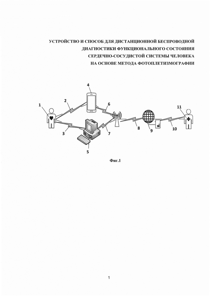 Устройство и способ для дистанционной беспроводной диагностики функционального состояния сердечно-сосудистой системы человека на основе двигательной активности и фотоплетизмографии (патент 2657966)