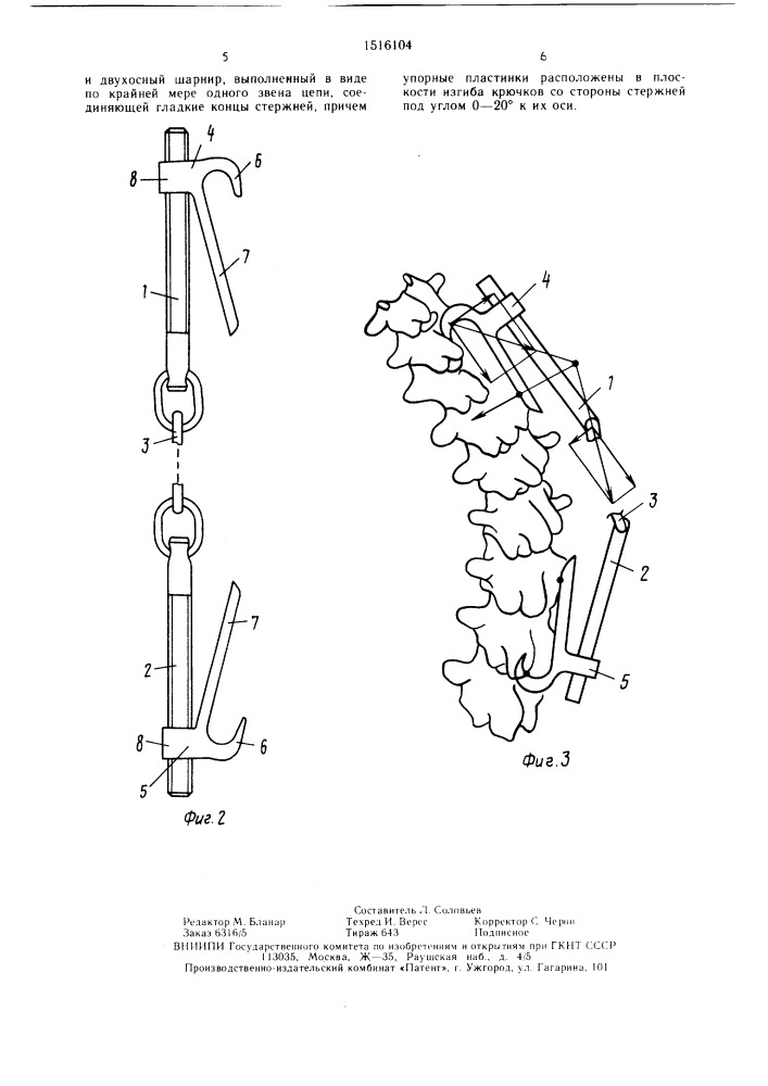 Контрактор для коррекции и фиксации позвоночника (патент 1516104)