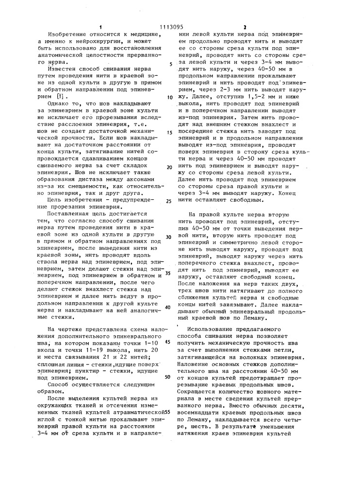 Способ сшивания нерва (патент 1113095)