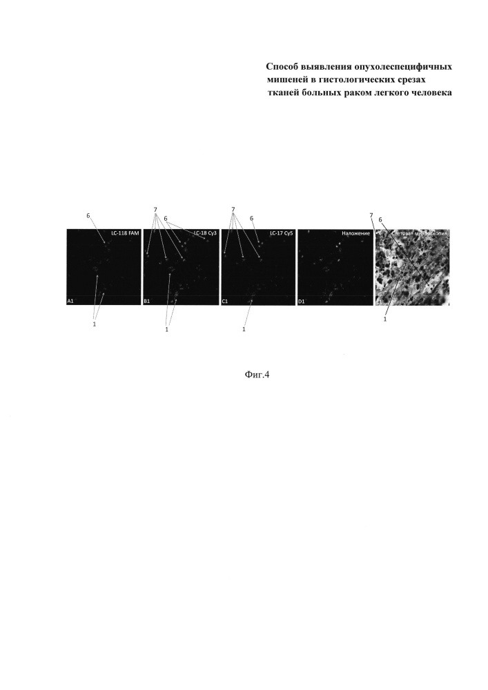 Способ выявления опухолеспецифичных мишеней в гистологических срезах тканей больных раком легкого человека (патент 2639238)