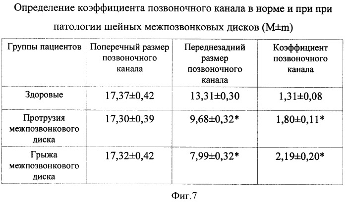 Способ ультразвуковой диагностики дорзальных протрузий и грыж шейных межпозвонковых дисков (патент 2421143)