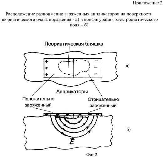 Способ наружного лечения локализованных форм псориаза (патент 2341301)