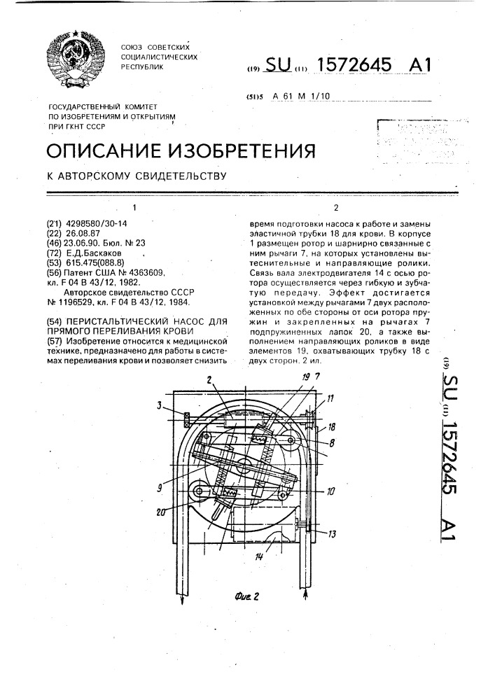 Перистальтический насос для прямого переливания крови (патент 1572645)