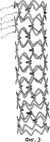 Расширяющийся гибкий стент, предназначенный для введения в кровеносные сосуды (патент 2342104)