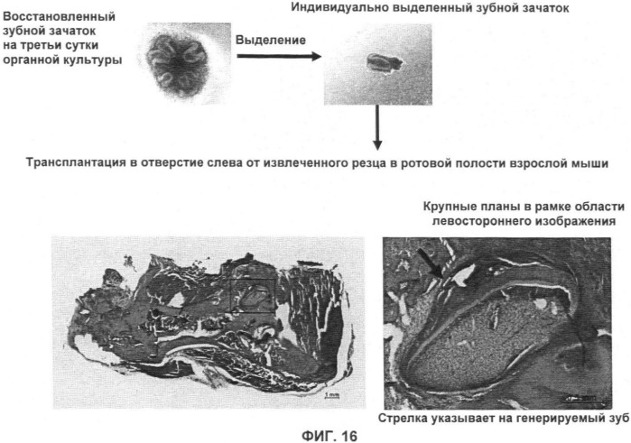Способ формирования зуба, зубной ряд и способ формирования ткани (патент 2428140)