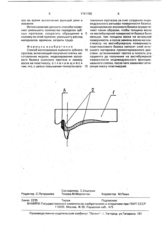 Способ изготовления съемного зубного протеза (патент 1741790)