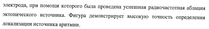 Способ неинвазивного электрофизиологического исследования сердца (патент 2417051)