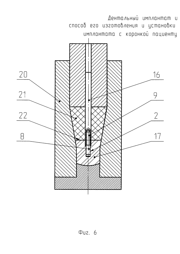 Дентальный имплантат и способ его изготовления (патент 2624169)