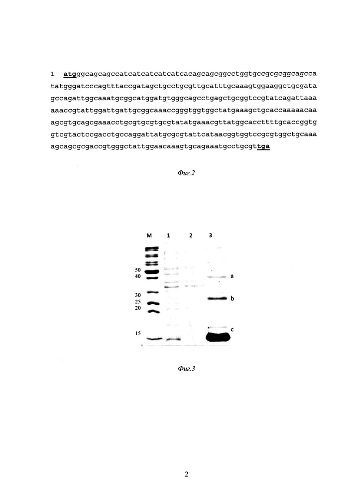 Рекомбинантная плазмидная днк pet15/n-dest+ и способ ее получения, штамм escherichia coli bl21(de3)gold, трансформированный рекомбинантной днк pet15/n-dest+, и способ его получения, способ получения рекомбинантного бифункционального фермента - дестабилазы медицинской пиявки (патент 2658429)