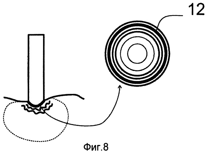 Крионаконечник с сапфировым хладопроводом-облучателем (патент 2496442)