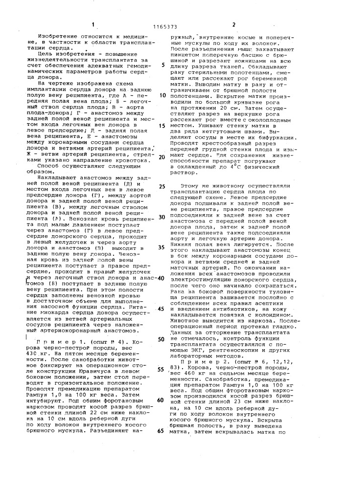 Способ трансплантации сердца (патент 1165373)