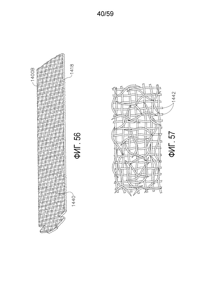 Расположение слоев для хирургических картриджей со скобками (патент 2661149)