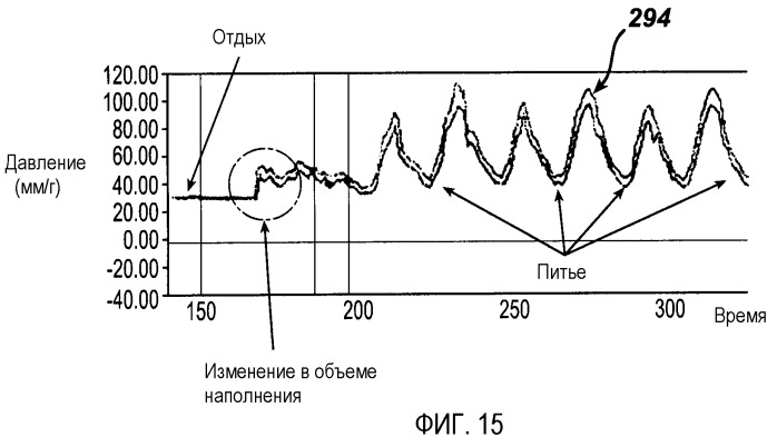 Дистанционный мониторинг и регулировка устройства ограничения потребления пищи (патент 2456918)