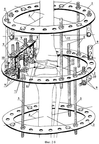 Устройство для лечения эпифизеолизов с переломом эпифиза длинных трубчатых костей (патент 2508064)