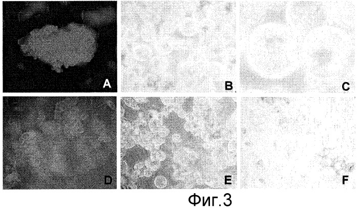 Способы in vitro для создания и поддержания линий растительных клеток в виде отдельных клеток в суспензии с интактными клеточными стенками и их трансформации (патент 2451744)