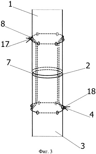 Способ наложения сухожильного шва (патент 2393807)