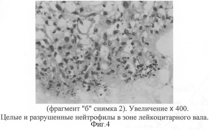 Способ моделирования острого некротического панкреатита (патент 2286608)