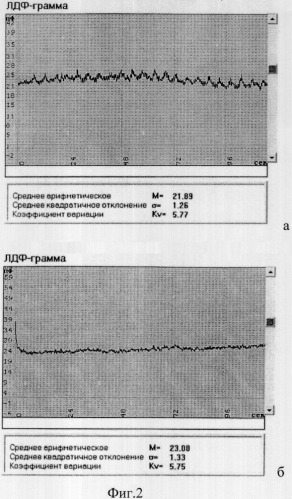 Способ ранней диагностики выраженности корешкового болевого синдрома после дискэктомии (патент 2325104)