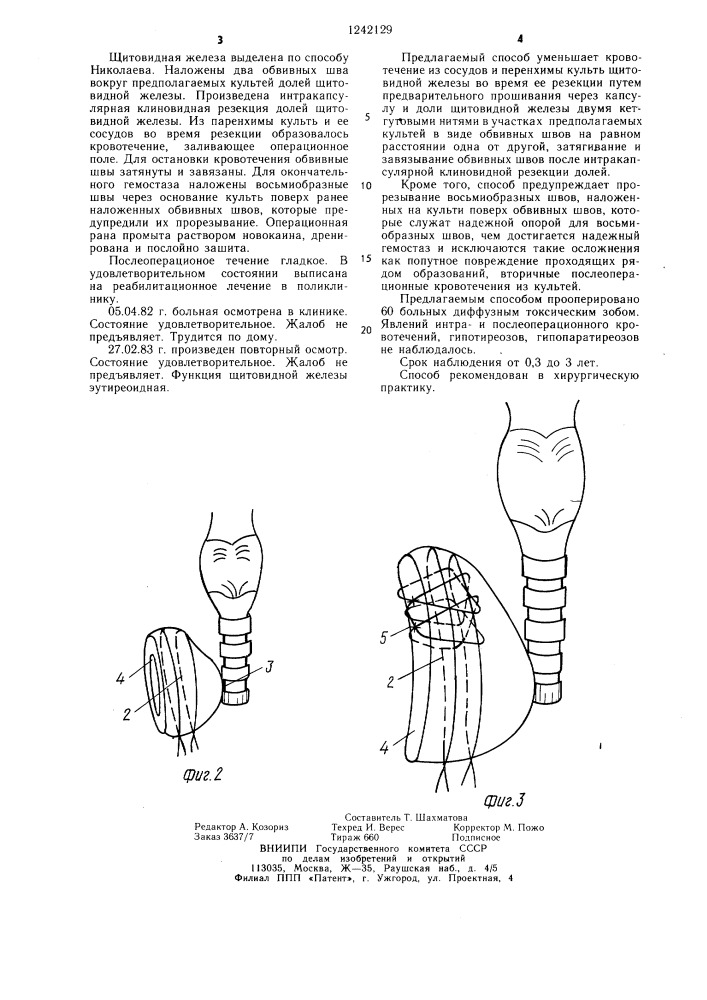 Способ резекции щитовидной железы (патент 1242129)