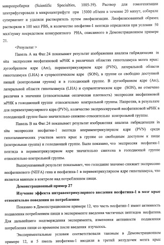 Способ получения фактора, связанного с контролем над потреблением пищи и/или массой тела, полипептид, обладающий активностью подавления потребления пищи и/или прибавления в весе, молекула нуклеиновой кислоты, кодирующая полипептид, способы и применение полипептида (патент 2418002)