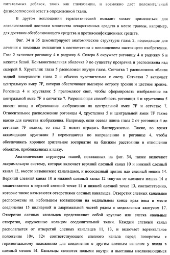 Лекарственные ядра для замедленного высвобождения терапевтических средств (патент 2478366)