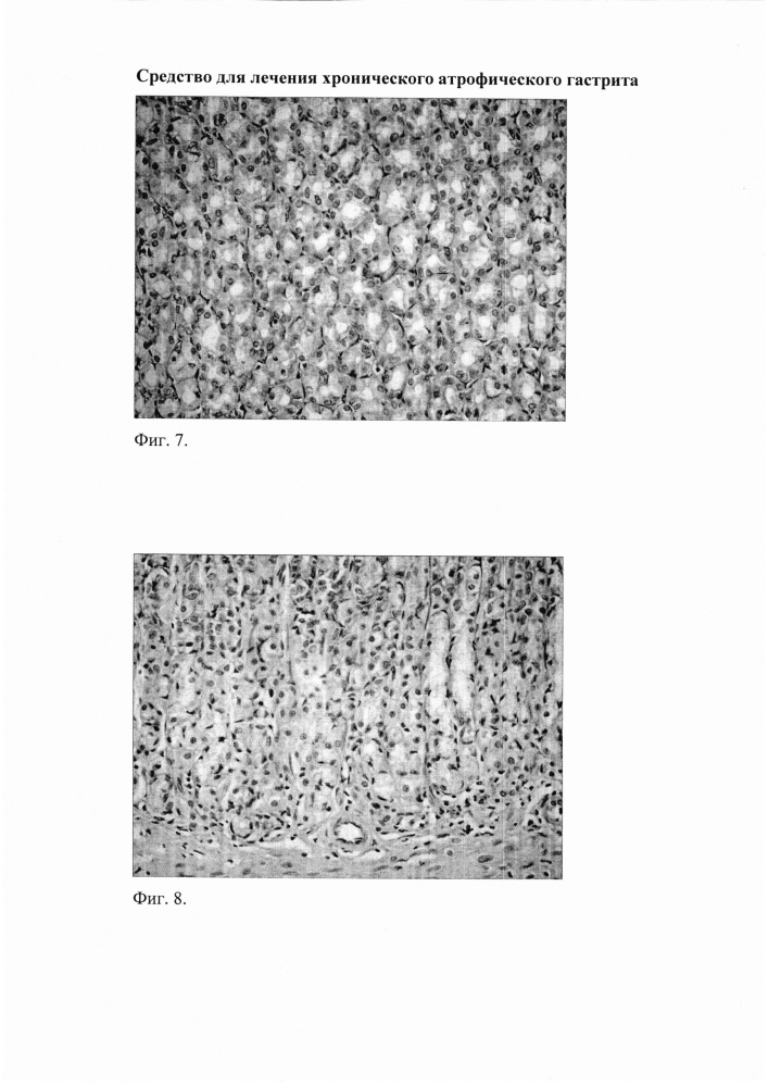 Средство для лечения хронического атрофического гастрита (патент 2662077)