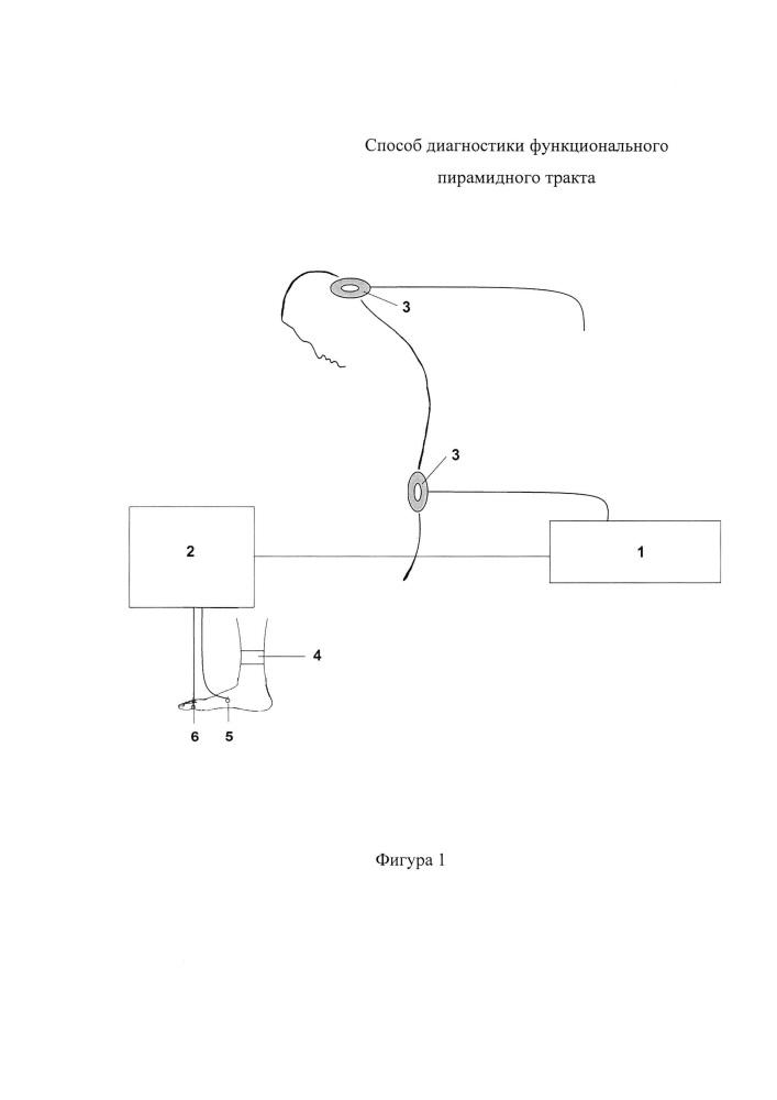 Способ диагностики функционального состояния пирамидного тракта (патент 2652068)