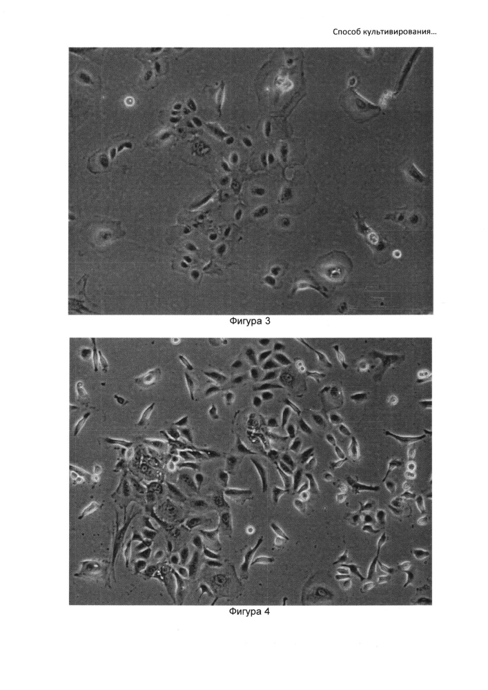 Способ культивирования клеток слюнной железы человека (патент 2631005)