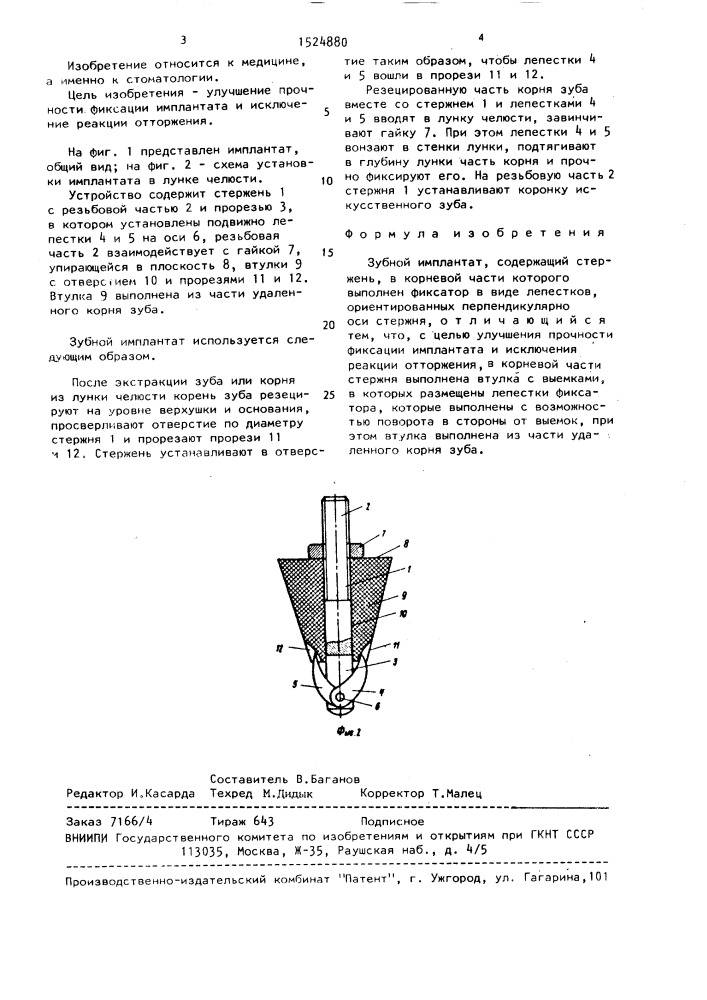 Зубной имплантат (патент 1524880)