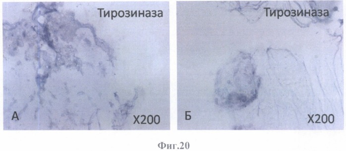 Способ моделирования тканевой структуры сетчатки глаза человека (патент 2486603)