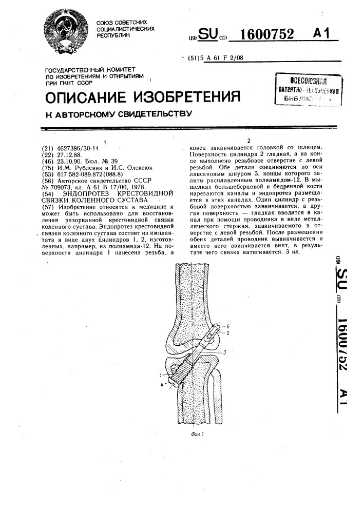 Эндопротез крестовидной связки коленного сустава (патент 1600752)