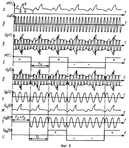 Устройство для дистанционного слежения за деятельностью сердца (патент 2318433)