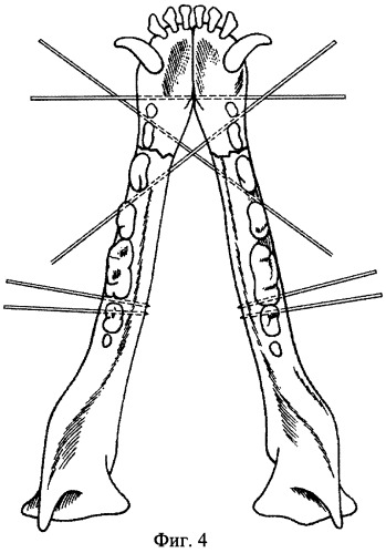 Способ остеосинтеза нижней челюсти животных (патент 2404725)