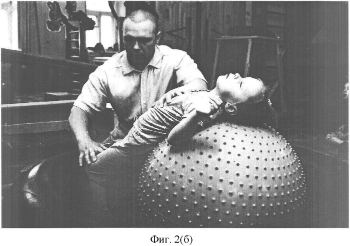 Способ реабилитации детей с болезнями нервной системы (патент 2358707)