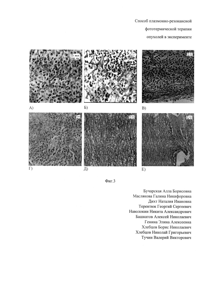 Способ плазмонно-резонансной фототермической терапии опухолей в эксперименте (патент 2614507)