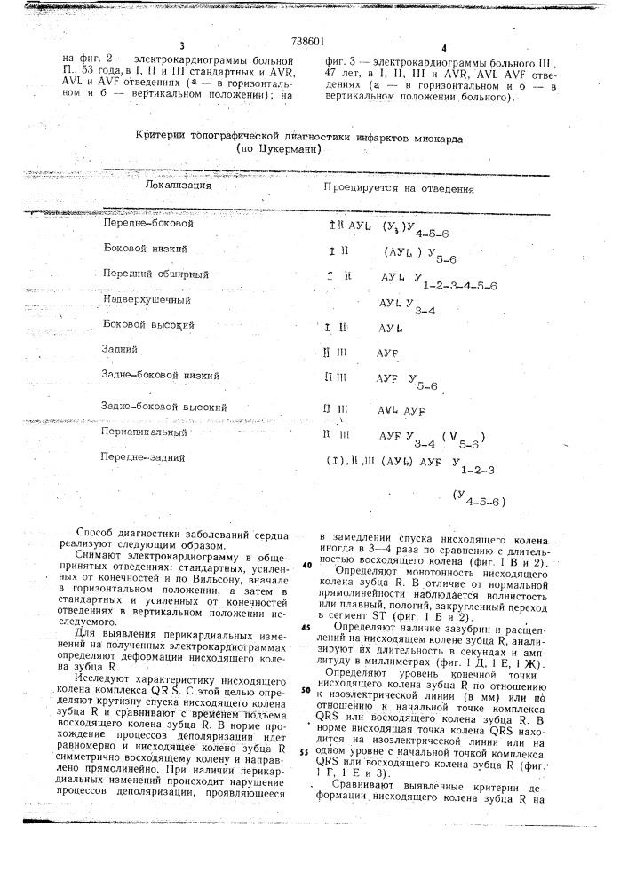 Способ диагностики заболеваний сердца (патент 738601)