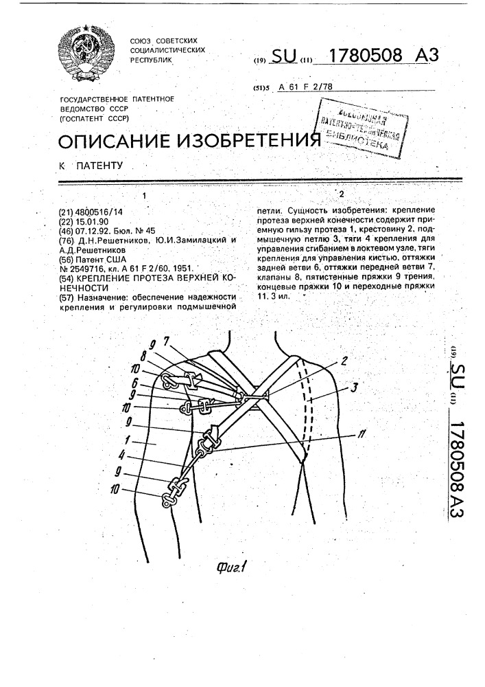 Крепление протеза верхней конечности (патент 1780508)