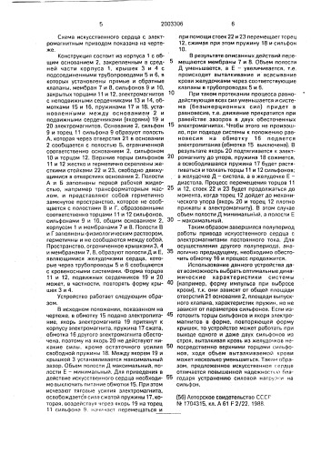 Искусственное сердце (патент 2003306)