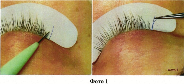 Способ наращивания ресниц "lash-to-lash" (патент 2541953)