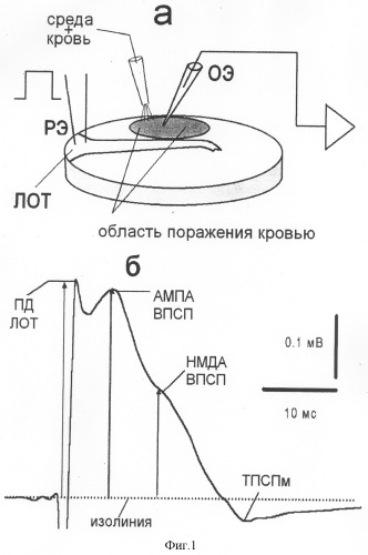 Способ моделирования и исследования последствий геморрагического инсульта (патент 2307396)