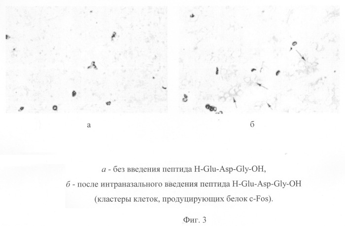 Пептид, обладающий стресспротекторным действием, фармацевтическая композиция на его основе и способ ее применения (патент 2304444)