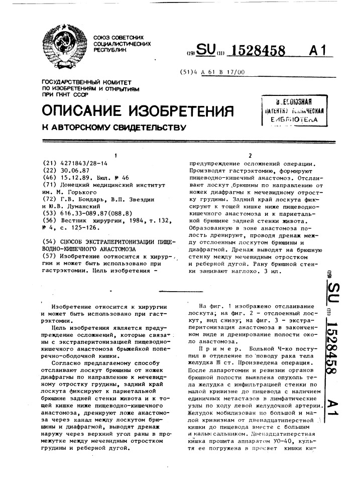 Способ экстраперитонизации пищеводно-кишечного анастомоза (патент 1528458)