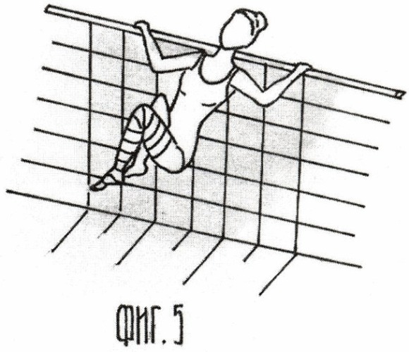 Способ лечебной гимнастики в воде после эндоваскулярной лазерной коагуляции вен нижних конечностей (патент 2441636)