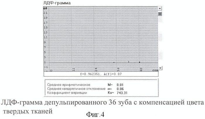 Способ диагностики витальности пульпы зуба (патент 2355292)