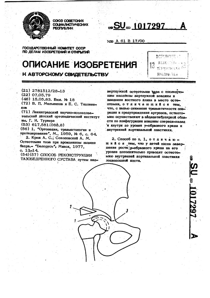 Способ реконструкции тазобедренного сустава (патент 1017297)