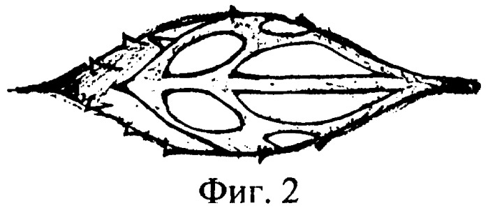 Способ разделения семян эспарцета и чернокорня (патент 2316936)