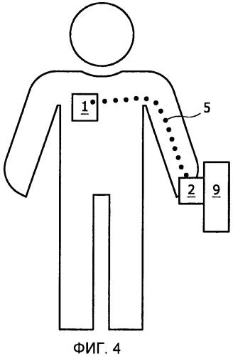 Беспроводное наблюдение за пациентом с использованием потоковой передачи медицинских данных с помощью связанного с телом соединения (патент 2490799)