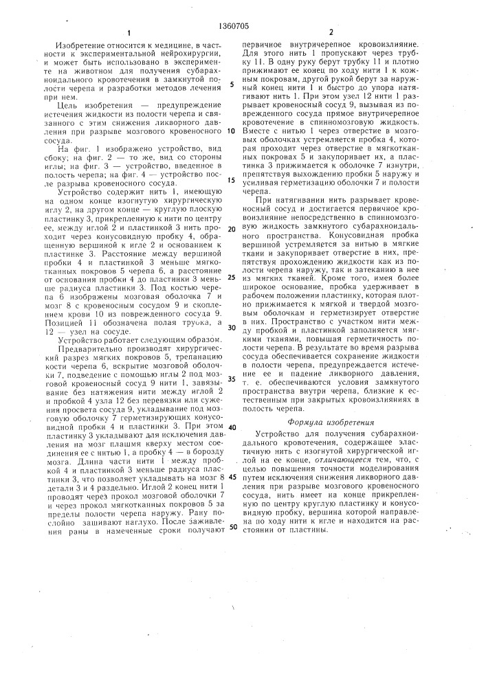 Устройство для получения субарахноидального кровотечения (патент 1360705)